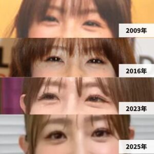 ビフォーアフター画像まとめ